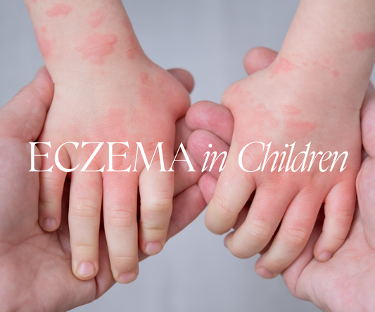 Doctor Rogers Skincare Blog: Eczema in Children (hands with Eczema displayed)