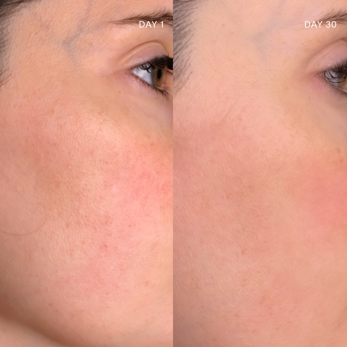 Doctor Rogers Skin Care | Restore Face Cream | Doctor Rogers Skincare | Restore Face Cream | Formulated with the best skincare ingredients to hydrate and repair all all skin types -  including mature, sensitive, dry and acne prone skin. 
Pictured Before and after 30 day results of middle-aged women who used Doctor Rogers Face Cream to hydrate dry, sensitive skin and reduce dark spots and wrinkles