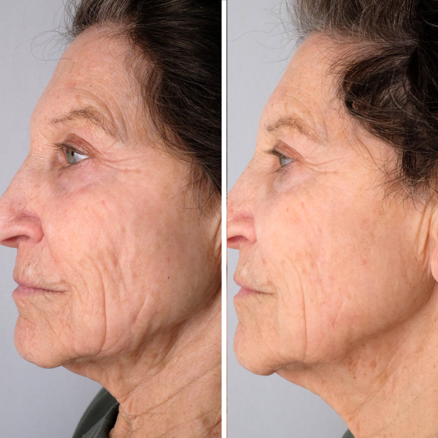 Before (left) and after (right) photos of woman with mature skin who used  Doctor Rogers Night Repair Treatment | A gentle retinol alternative for aging skin made to fight wrinkles, smooth fine lines and stimulate skin renewal