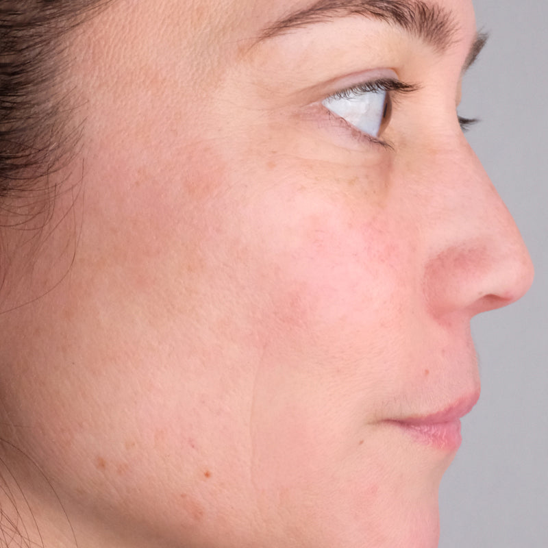 Woman age 30 - 50 who participated in Doctor Rogers Advance Duo Treatment Study displaying side profile of face after using Doctor Rogers Day Preventive Treatment and Night Repair Treatment displaying improved skin tone, reduced wrinkles and minimized fine lines. 