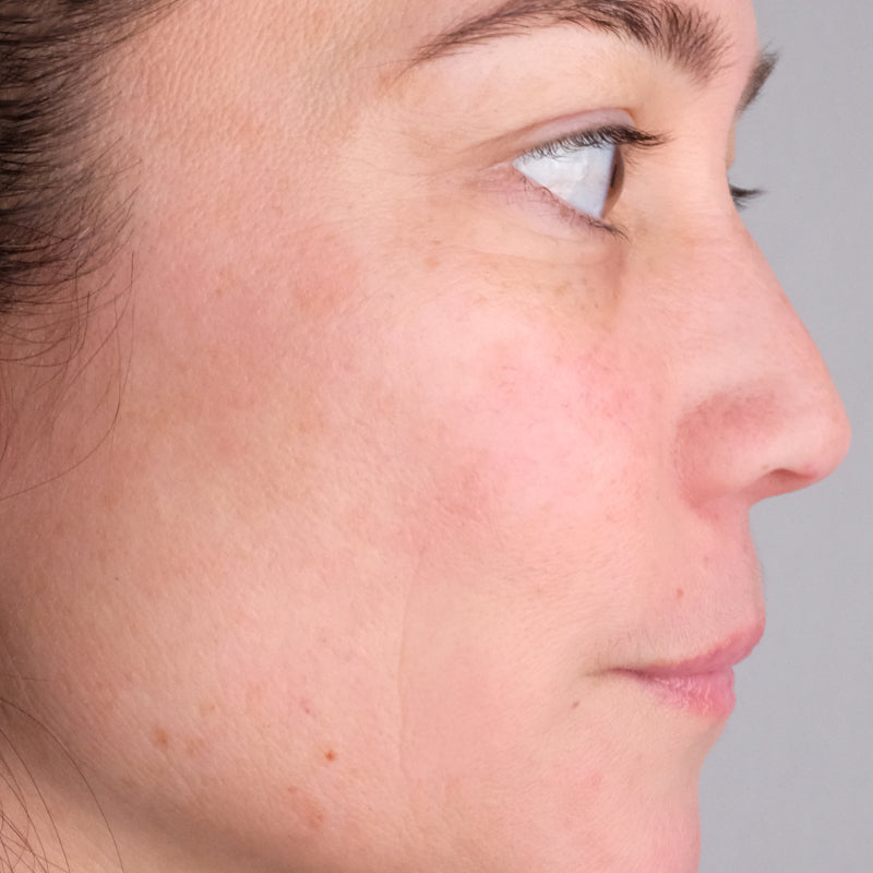 Woman age 30 - 50 who participated in Doctor Rogers Advance Duo Treatment Study displaying side profile of face after using Doctor Rogers Day Preventive Treatment and Night Repair Treatment displaying improved skin tone, reduced wrinkles and minimized fine lines.