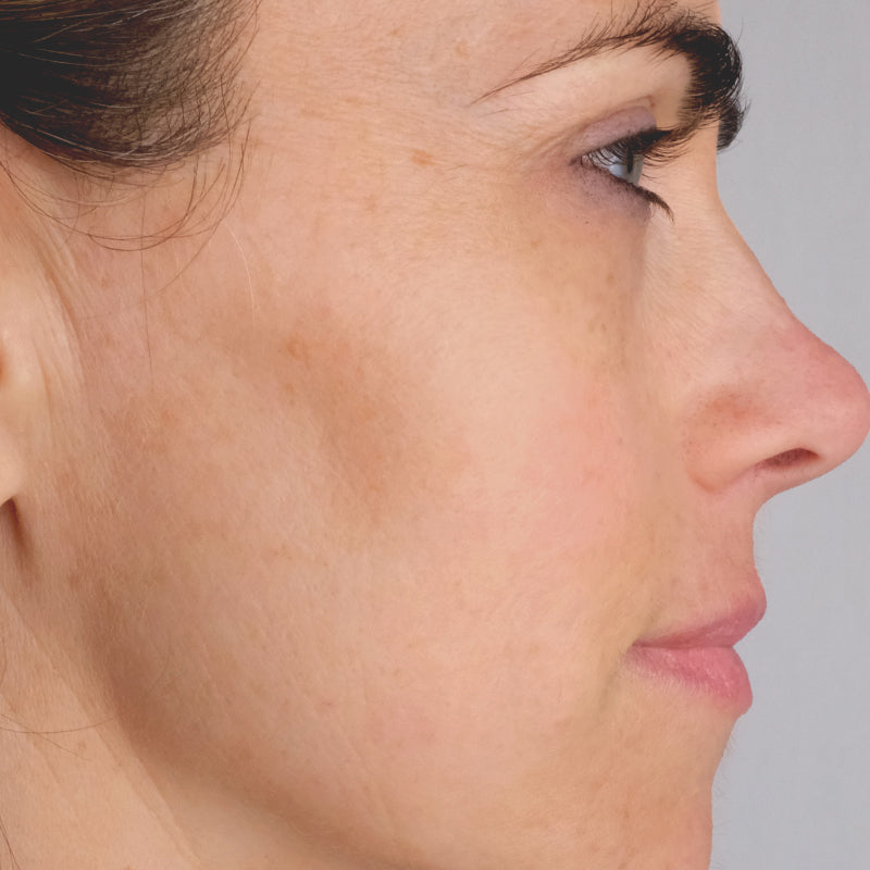 Woman age 30 - 50 who participated in Doctor Rogers Advance Duo Treatment Study displaying side profile of face after using Doctor Rogers Day Preventive Treatment and Night Repair Treatment displaying improved skin tone, reduced wrinkles and minimized fine lines.