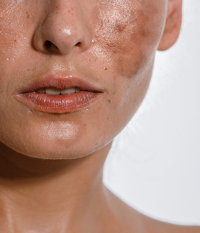 Dermatologist Explains: Skincare in Your 40s -- Needing More, Tolerating Less