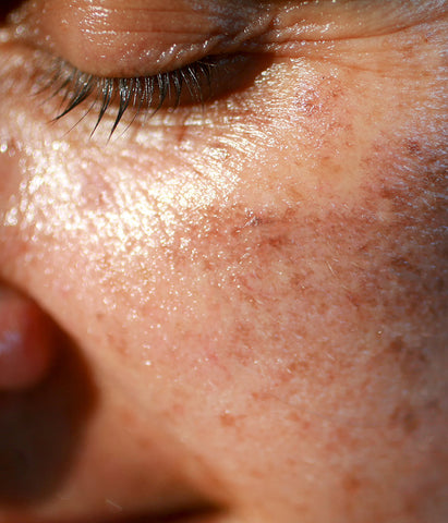 Dermatologist Explains: Skincare in Your 40s -- Needing More, Tolerating Less