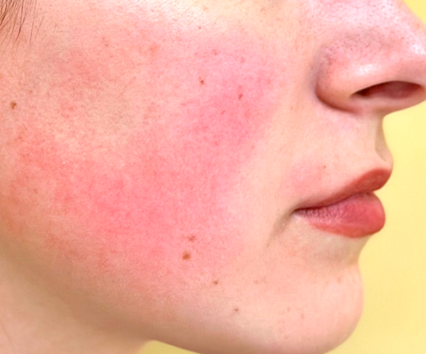 A Guide to Face Washing