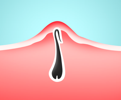 10 Winter Skin Tips From a Dermatologist