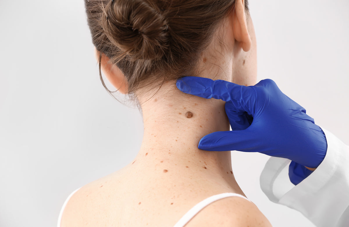 Book a Skin Check!