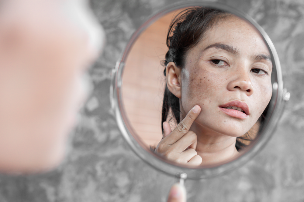 Which Laser is Right for Me?