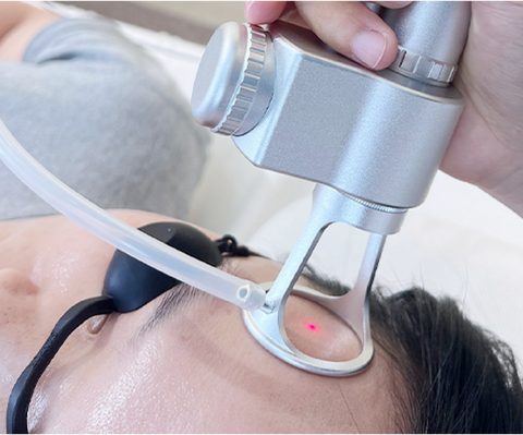 Resurfacing Lasers Explained by a Dermatologist: UltraClear, Halo, Fraxel & More