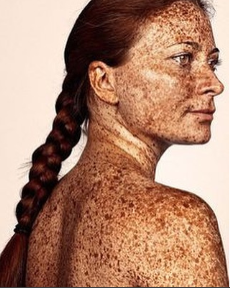 5 Skin Myths Busted by Dr. Heather Rogers