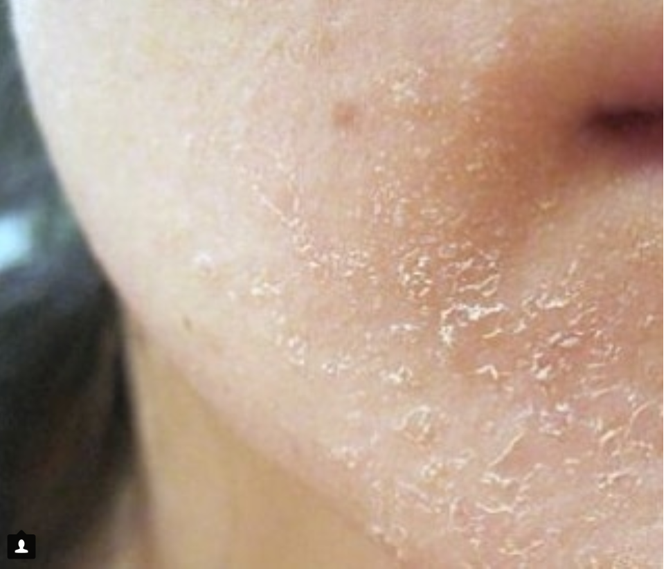So what’s so GREAT about your Healing Balm?