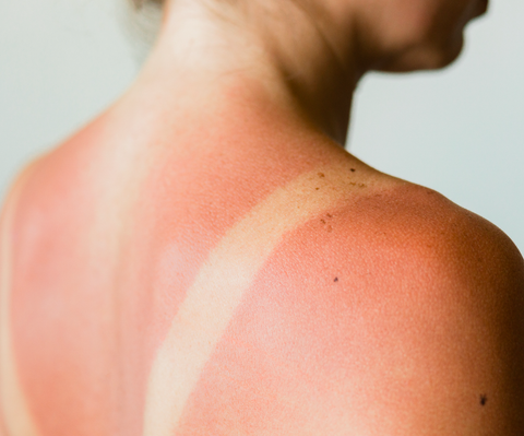 Sunscreen Guide 2025: Everything You Need to Know From a Dermatologist