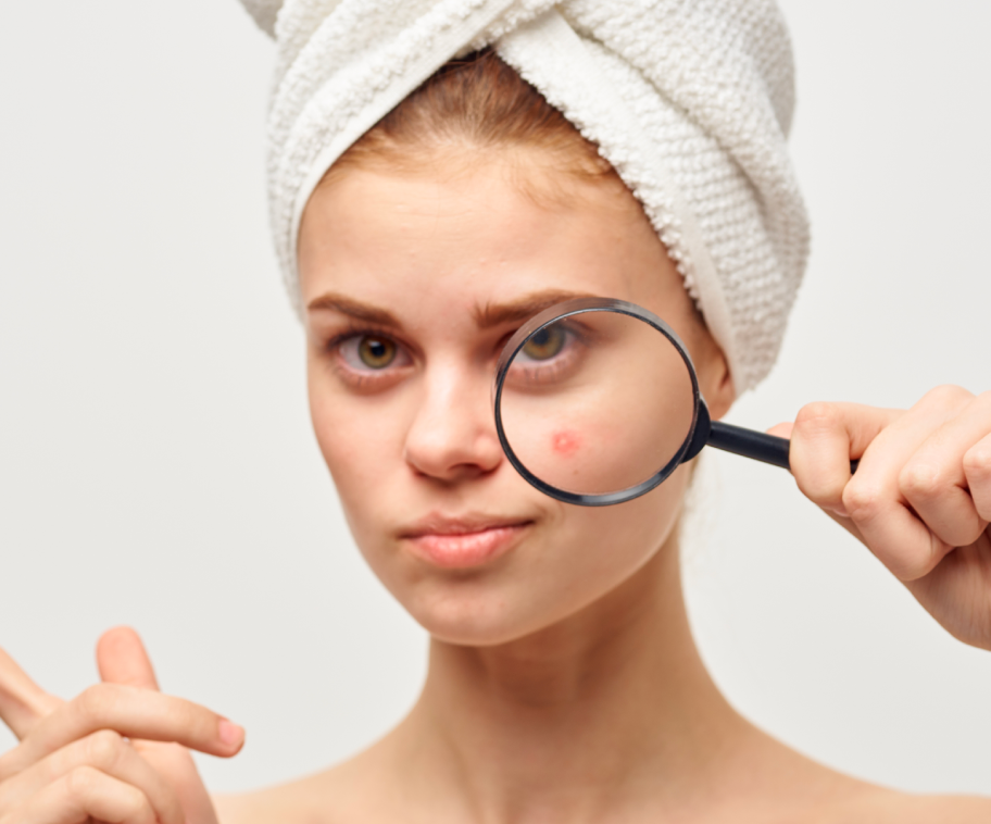Zit Object How to Treat a Zit | Heather D. Rogers, MD – Doctor Rogers Skin Care