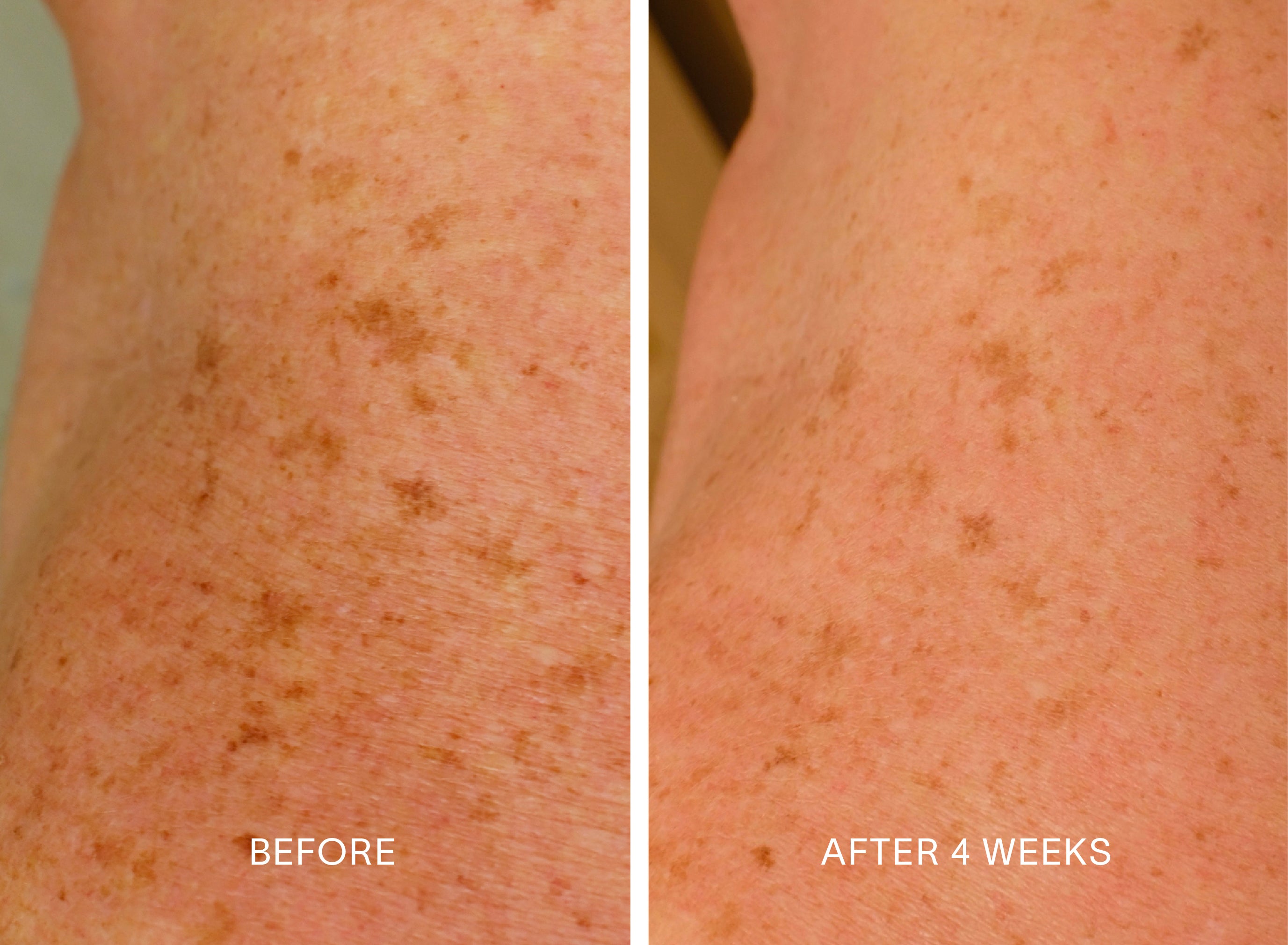 Body Duo | Smooth Crepey Skin & Deeply Hydrate – Doctor Rogers